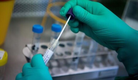 Akıncılar'da PCR testi yapılacak