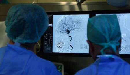 Depresyonun kodlarının çözülmesi için sinir devreleri inceleniyor