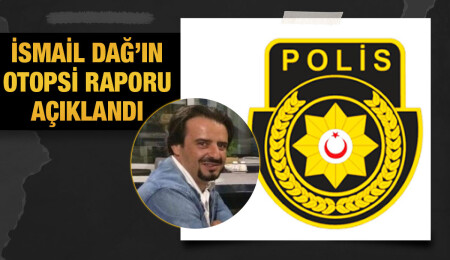 Otel odasında hayatını kaybeden İsmail Dağ’ın ölüm sebebinin “beyin kanaması” sonucu olduğu bildirildi