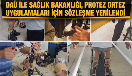 DAÜ ile Sağlık Bakanlığı, protez ortez uygulamaları için sözleşme yenilendi