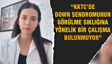 Doç. Dr. Zehra Topcu: Down sendromlu bireylerle ilgili en temel hedef onları topluma kazandırmaktır