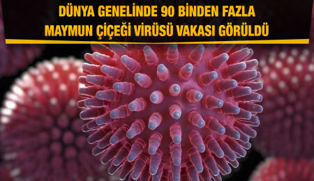 DSÖ: Dünya genelinde 90 binden fazla maymun çiçeği virüsü vakası görüldü