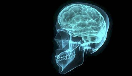 Neuralink'in beyin çipi taktığı ilk kişide sorunlar çıktı