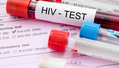 Türkiye'de 40 bin HIV pozitif vaka, 2 bin 300 AIDS hastası bulunuyor