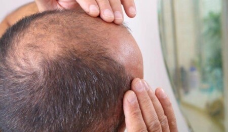 İngiltere'de erkeğe kel demek cinsel taciz sayıldı