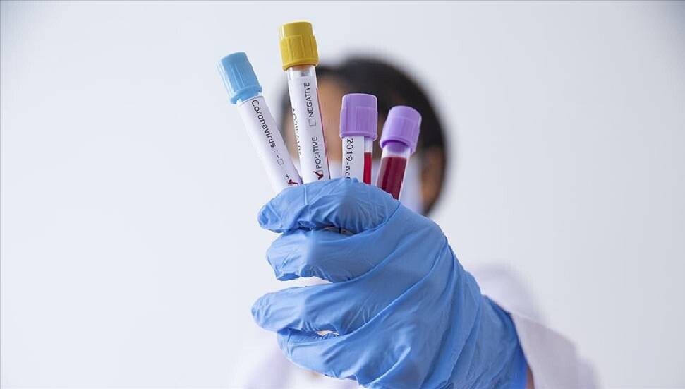 Dr. Sıla Usar İncirli uyardı: Koronavirüs vakaları artış gösteriyor, belirtilere dikkat!