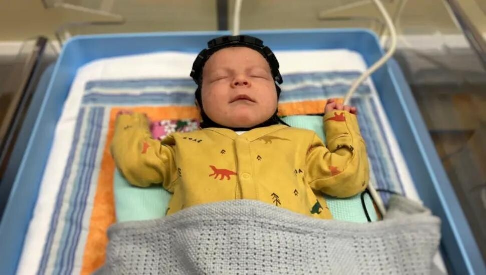 İngiltere'de bilim insanları doğumda beyin hasarını tespit edebilecek başlık geliştirdi