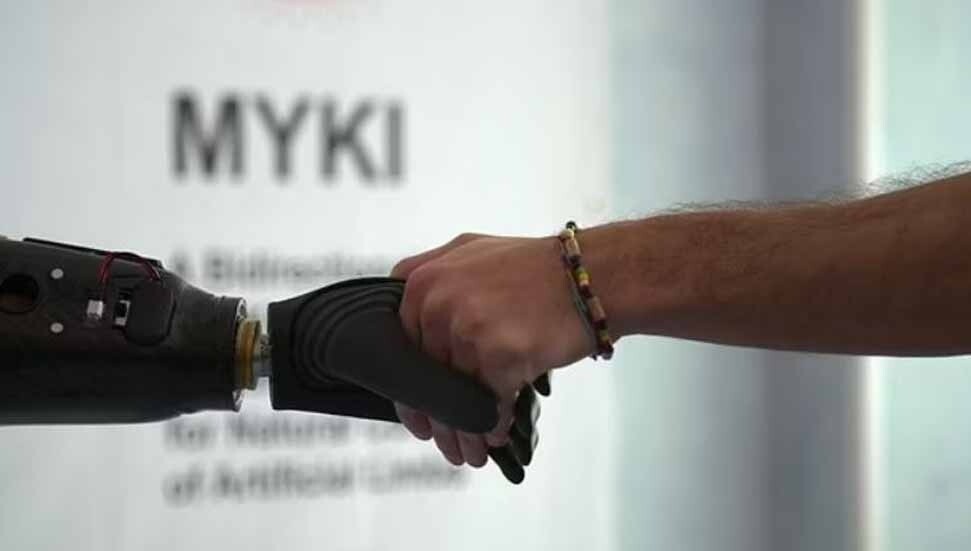 Düşünce gücüyle hareket eden biyonik el milyonlarca insana umut sağlayacak