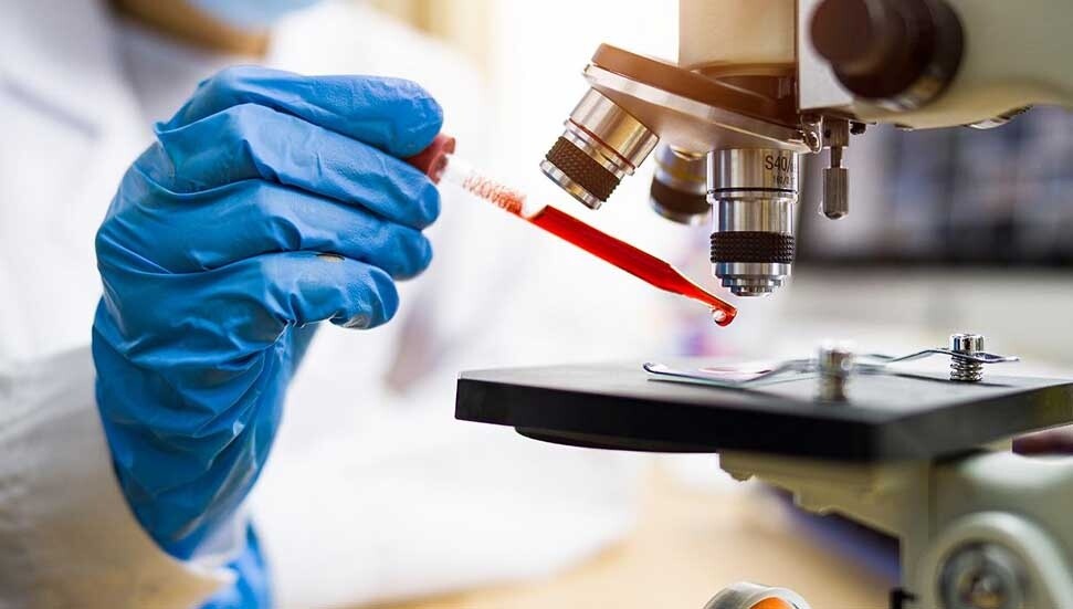 Kan testiyle hızlı ve yavaş yaşlanan organlar tespit edilebilir